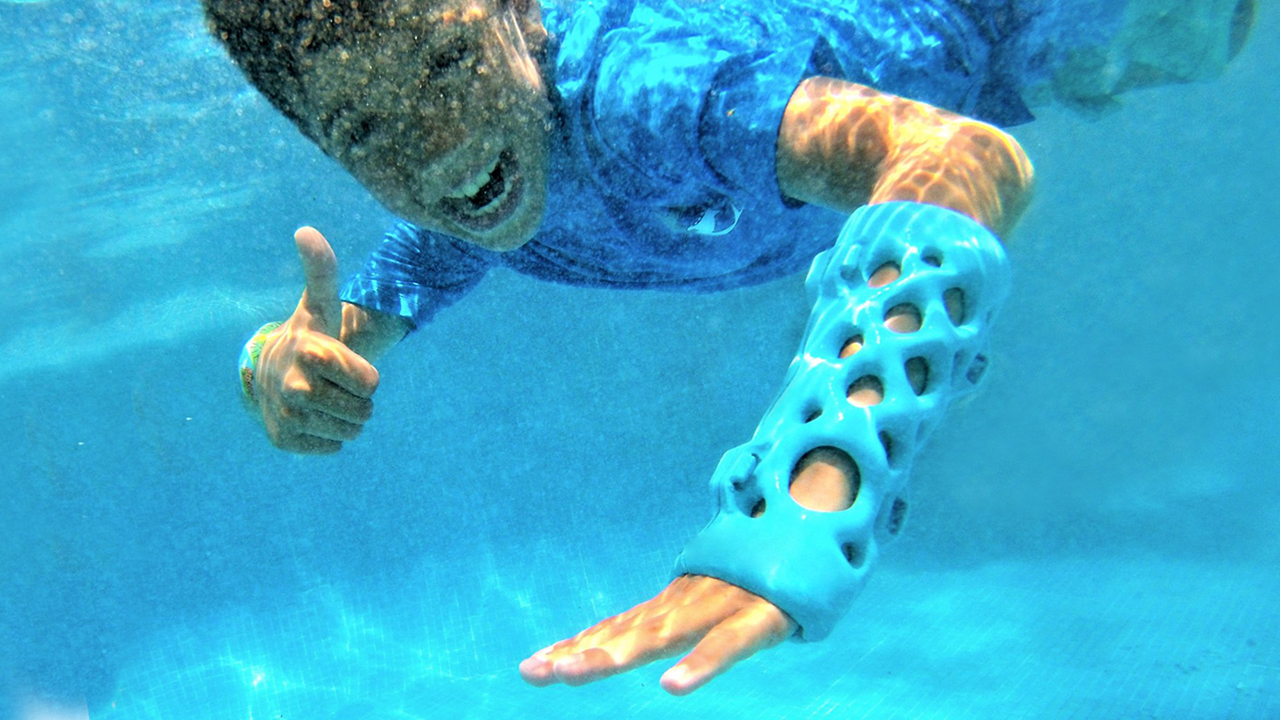 Child swimming underwater with 3D printed cast
