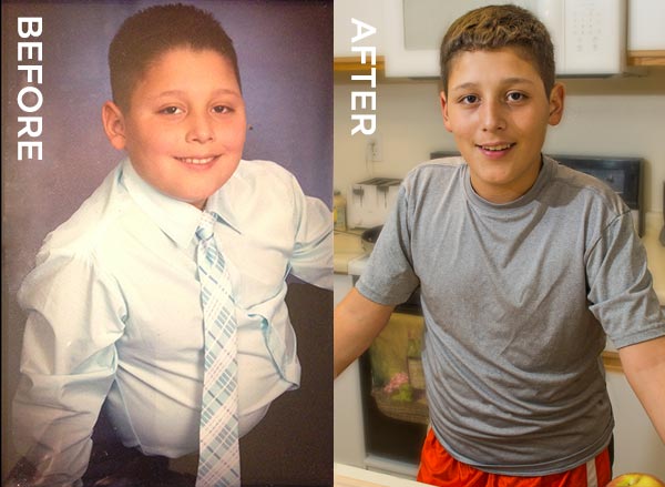 Before and after pictures of Brandon, patient of Children's Hospital Colorado's Weight Management Program.