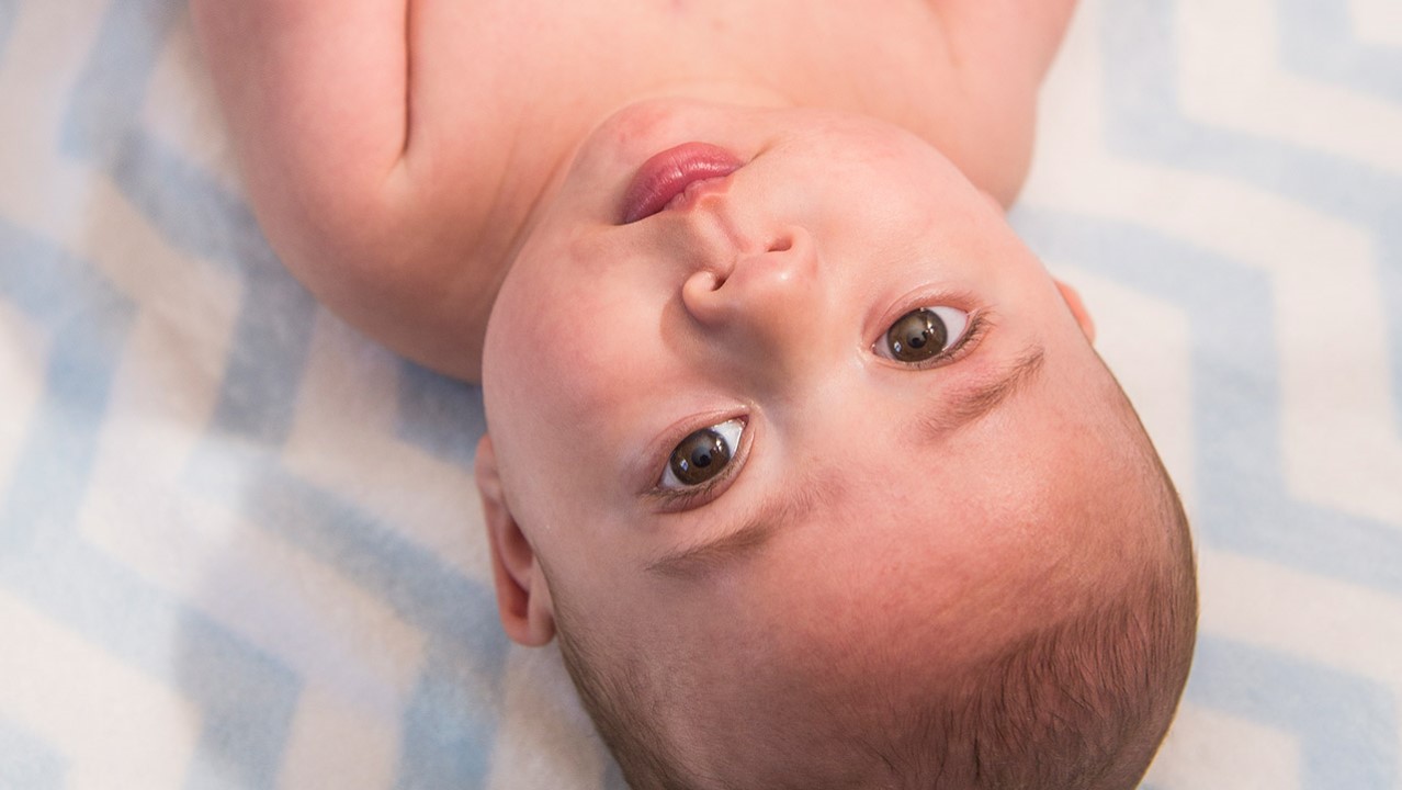 A closeup of a baby treated for hypoplastic left heart syndrome (HLHS) at Children's Hospital Colorado.