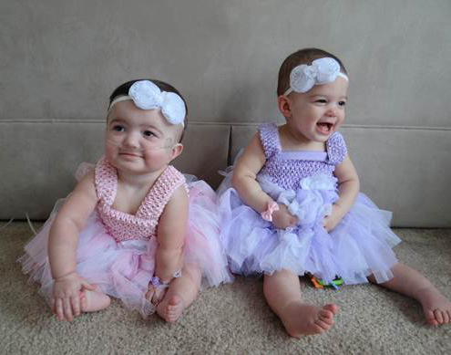Two TTTS twin girls in pink and purple dresses.