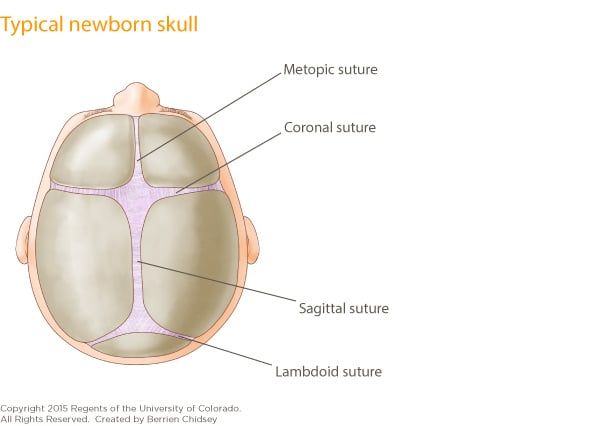An illustration of a newborn skull showing normal size and placement of the plates.