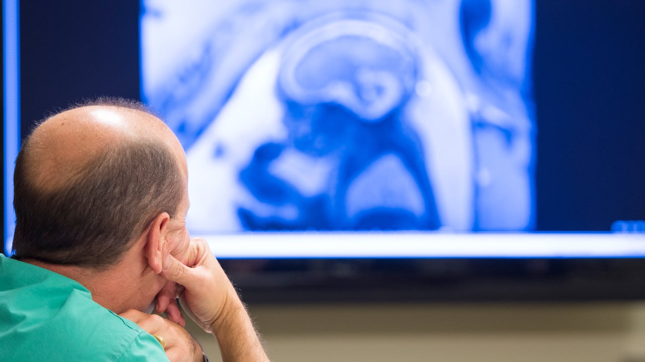 A doctor looks at a fetal ultrasound