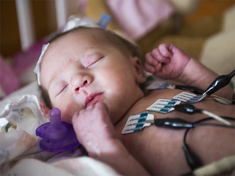 A newborn baby lays on its back and is hooked up to cardiac monitors at the Heart Institute at Children's Hospital Colorado.