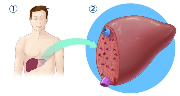 An illustration of an adult man with his liver shown and a blue arrow pointing to a close-up of an illustrated liver on a blue circle.
