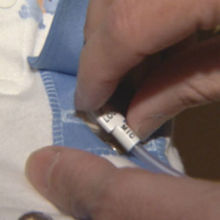 Close-up of a NICU baby being treated with a g-tube.