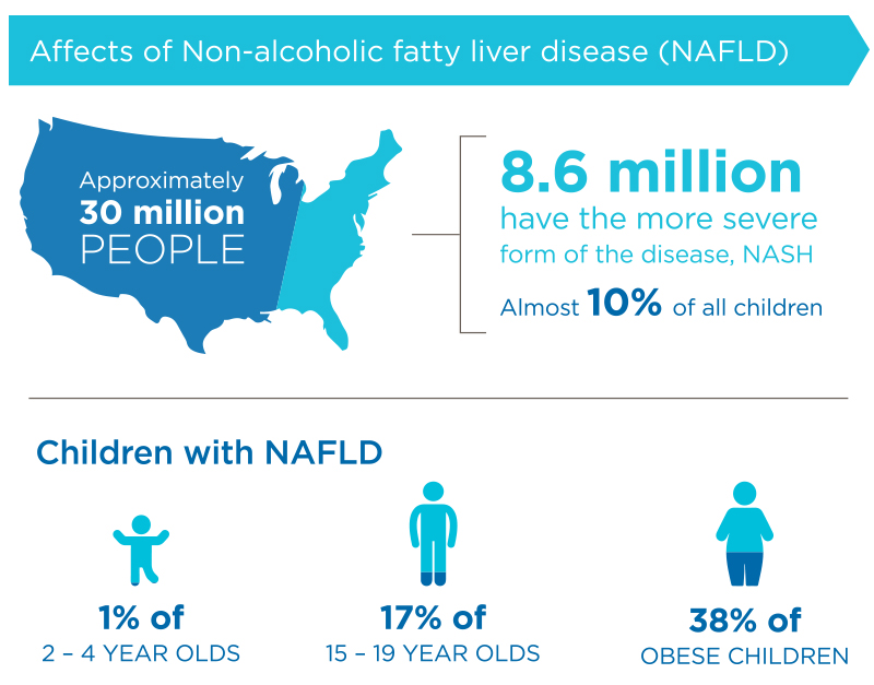 Graphic shows 30 million people have non-alcohol fatty liver disease, 8.6 million have NASH, 1% of 2-4 year olds have NAFLD, 17% of 15-19 year olds have NAFLD, 38% of obese children have NAFLD.