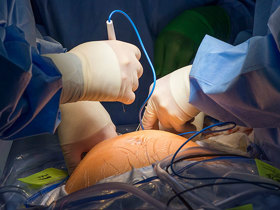 Surgeons  during surgery.