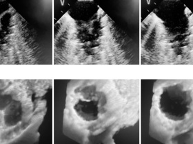 Grid of six ultrasound images