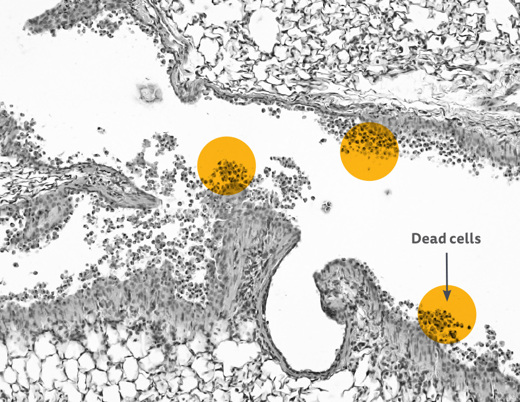Microscope image with yellow circles. One is labeled "Dead Cells"